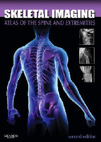 Skeletal Imaging: Atlas of the Spine and Extremities