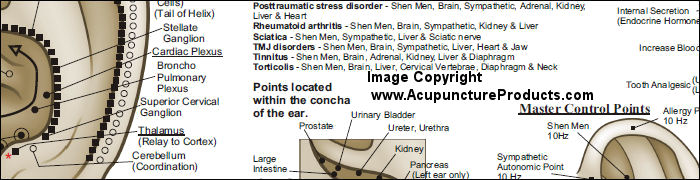Auriculotherapy Poster