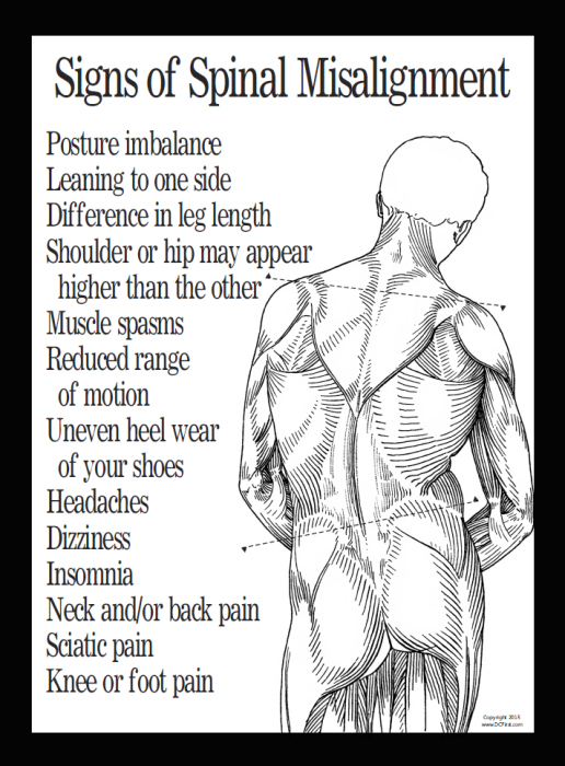 Signs of Spinal Misalignment