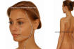 Acupuncture Meridians