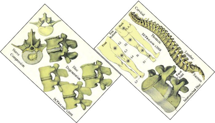 Chiropractic Wallet Patient Education Card