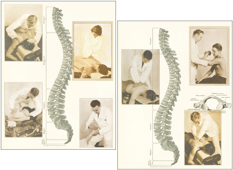 Chiropractic Posters