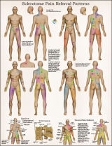 Sclerotome Poster