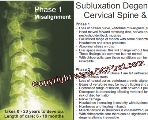 Spinal Decay Poster