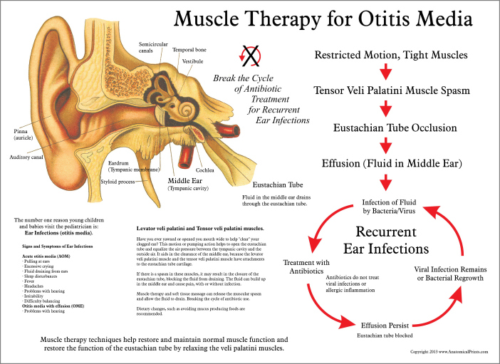 Muscle Therapy for Otitis Media Poster