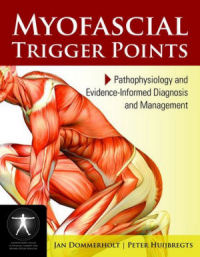 Myofascial Trigger Points: Pathophysiology and Evidence-Informed Diagnosis and Management