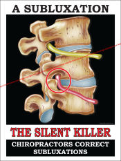 Chiropractic Subluxation Poster