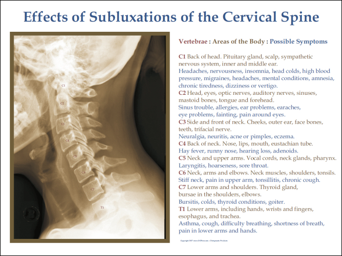 Chart Of Effects Of Vertebral Subluxations