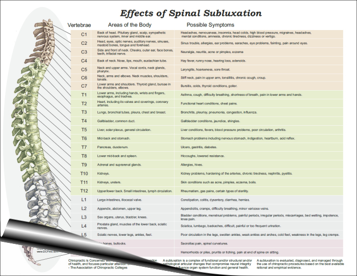 Vertebral Spinal Subluxation Symptoms Handout