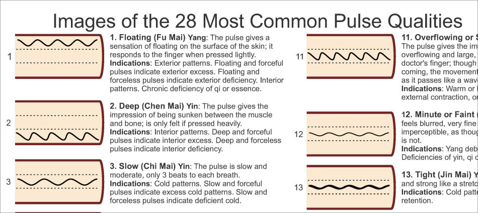 Pulse Diagnosis Poster