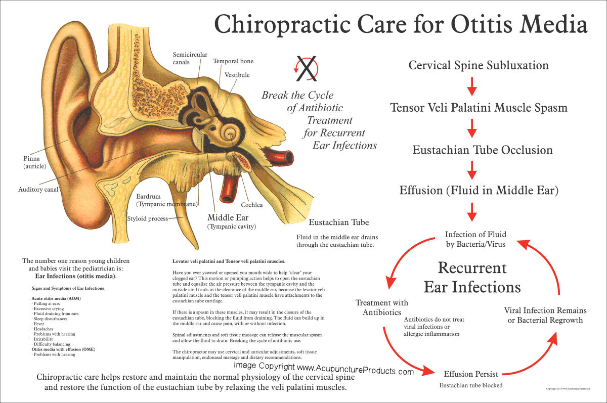 Chiropractic Care for Otitis Media Poster