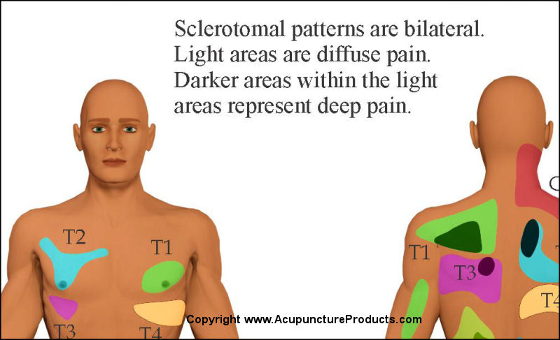 Visceral Referral Patterns Chart