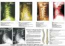 Chiropractic Posters